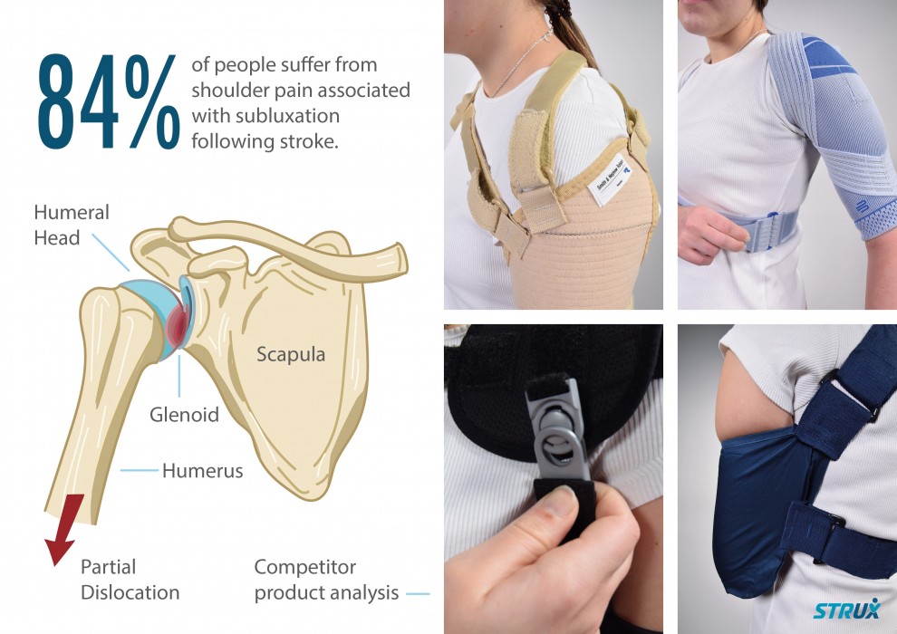 Myles Taylor’s STRUX is an active recovery orthosis for the treatment of shoulder subluxation (partial dislocation) following stroke.