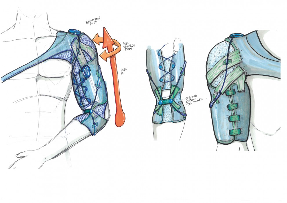 Myles Taylor’s STRUX is an active recovery orthosis for the treatment of shoulder subluxation (partial dislocation) following stroke.