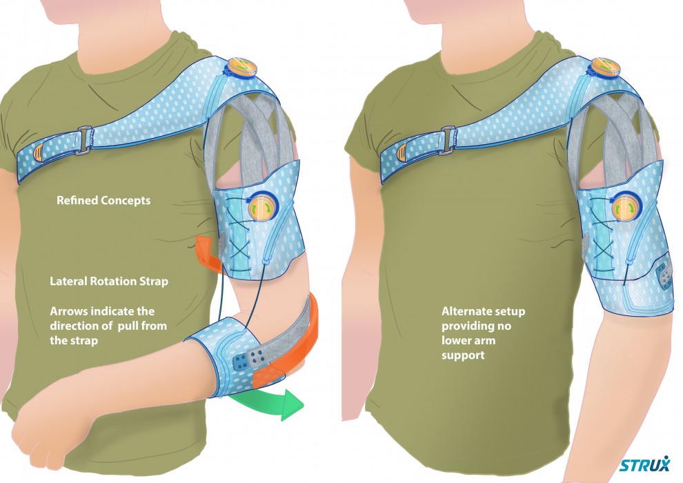 Myles Taylor’s STRUX is an active recovery orthosis for the treatment of shoulder subluxation (partial dislocation) following stroke.